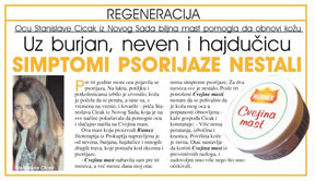 Simptomi psorijaze nestali